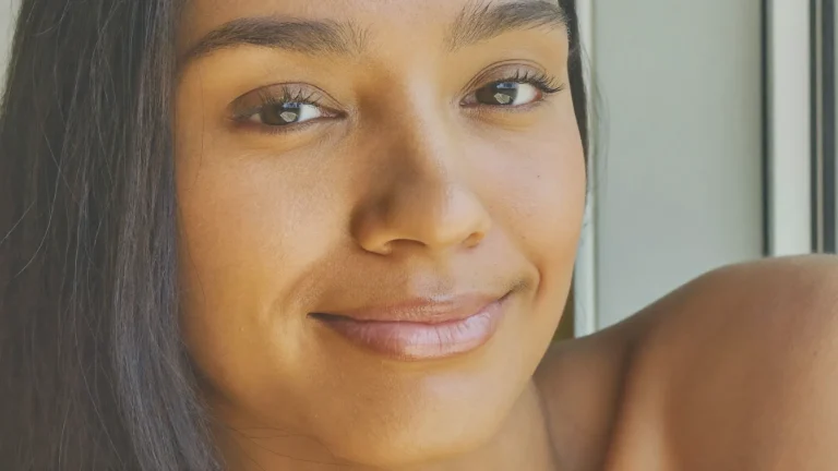 Mujer con piel sana y luminosa después del tratamiento de melasma