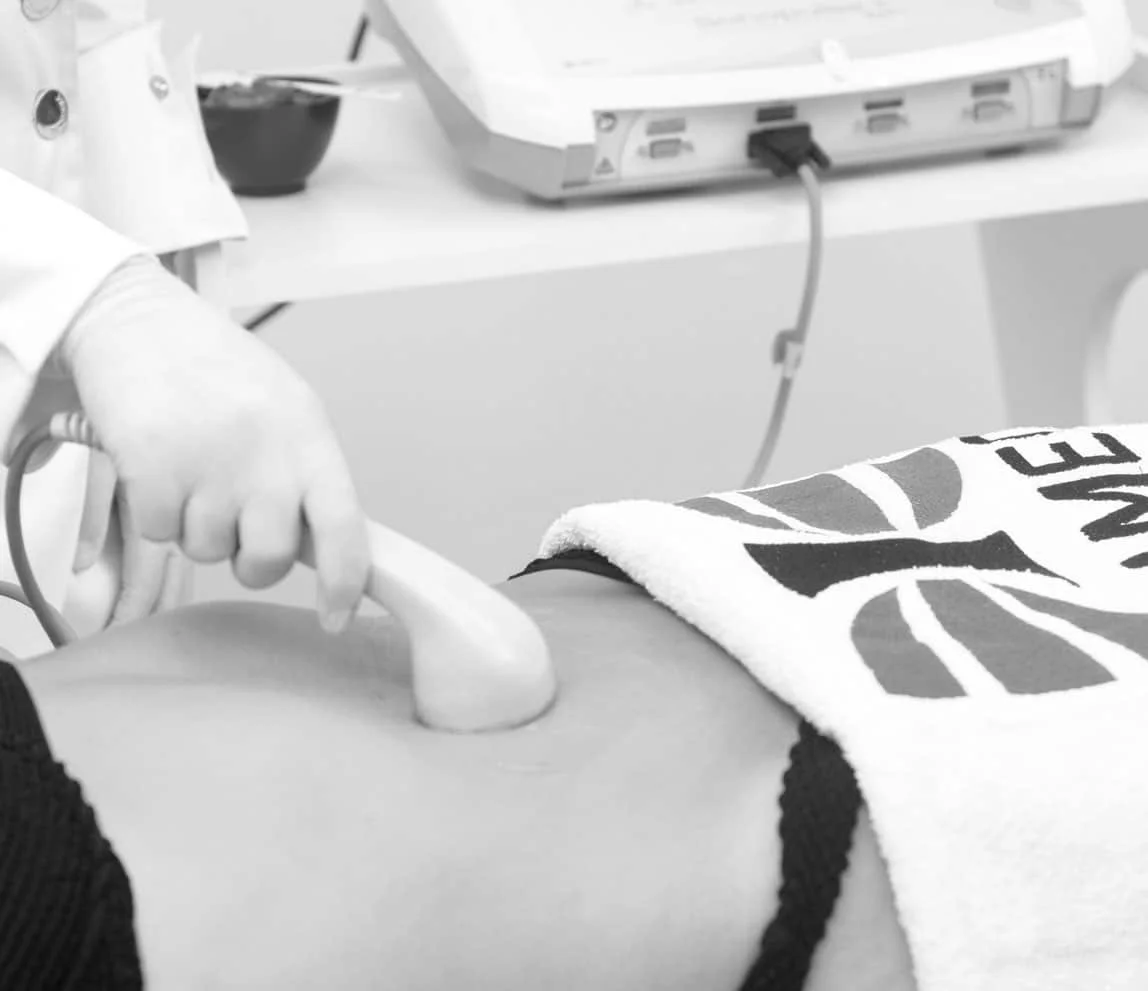 Sonopulse II Ibramed ultrasonido terapéutico - kinesiología en Viña del Mar